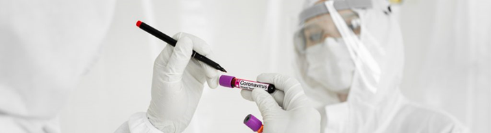 coronavirus sample